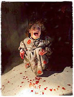 bloodspattered Iraqi child Pictures, Images and Photos