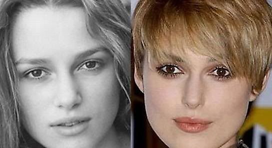 keira knightley nose job. KEIRA KNIGHTLEY.